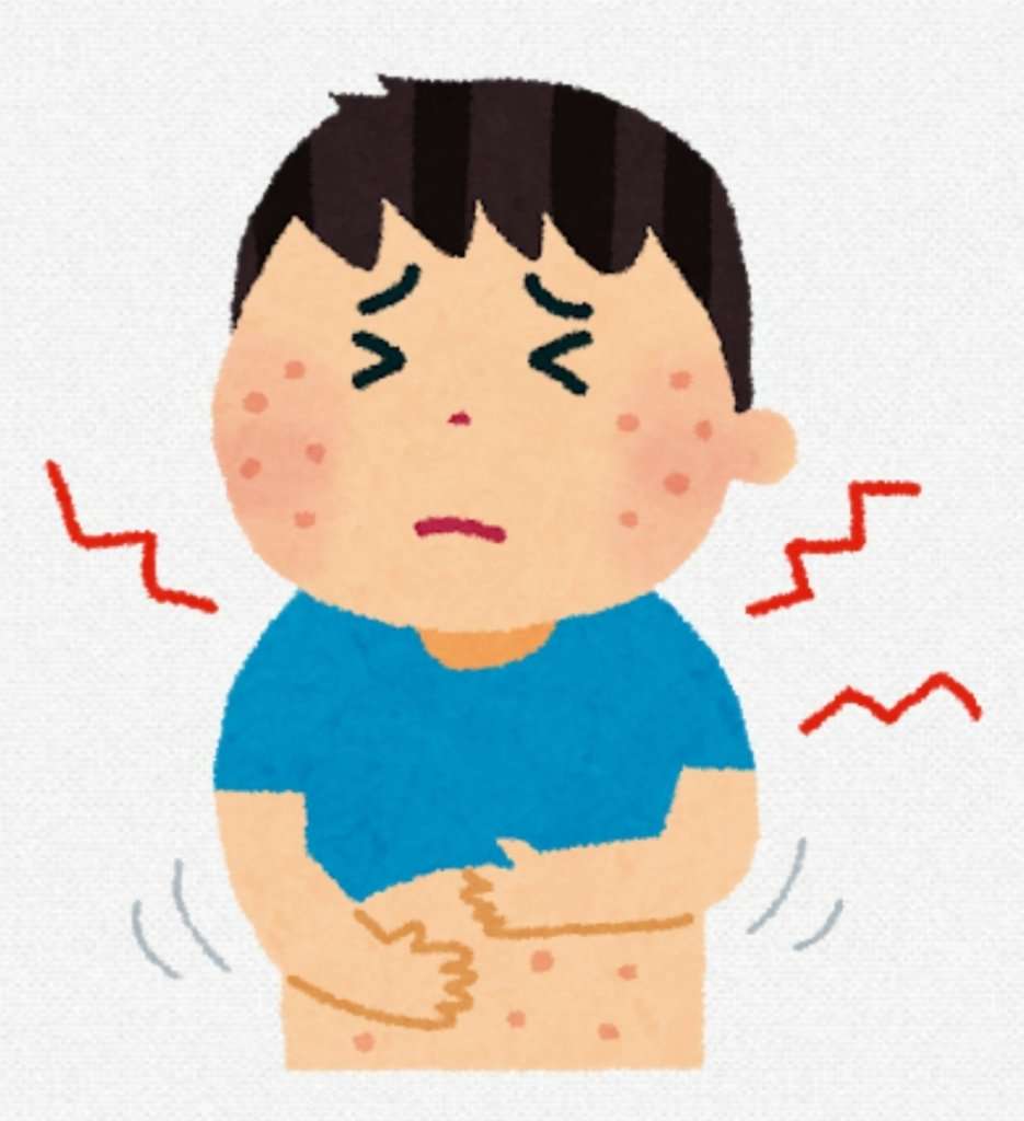 帯状疱疹 人生最悪の痛み 患者は増加傾向へ ガールズちゃんねる Girls Channel