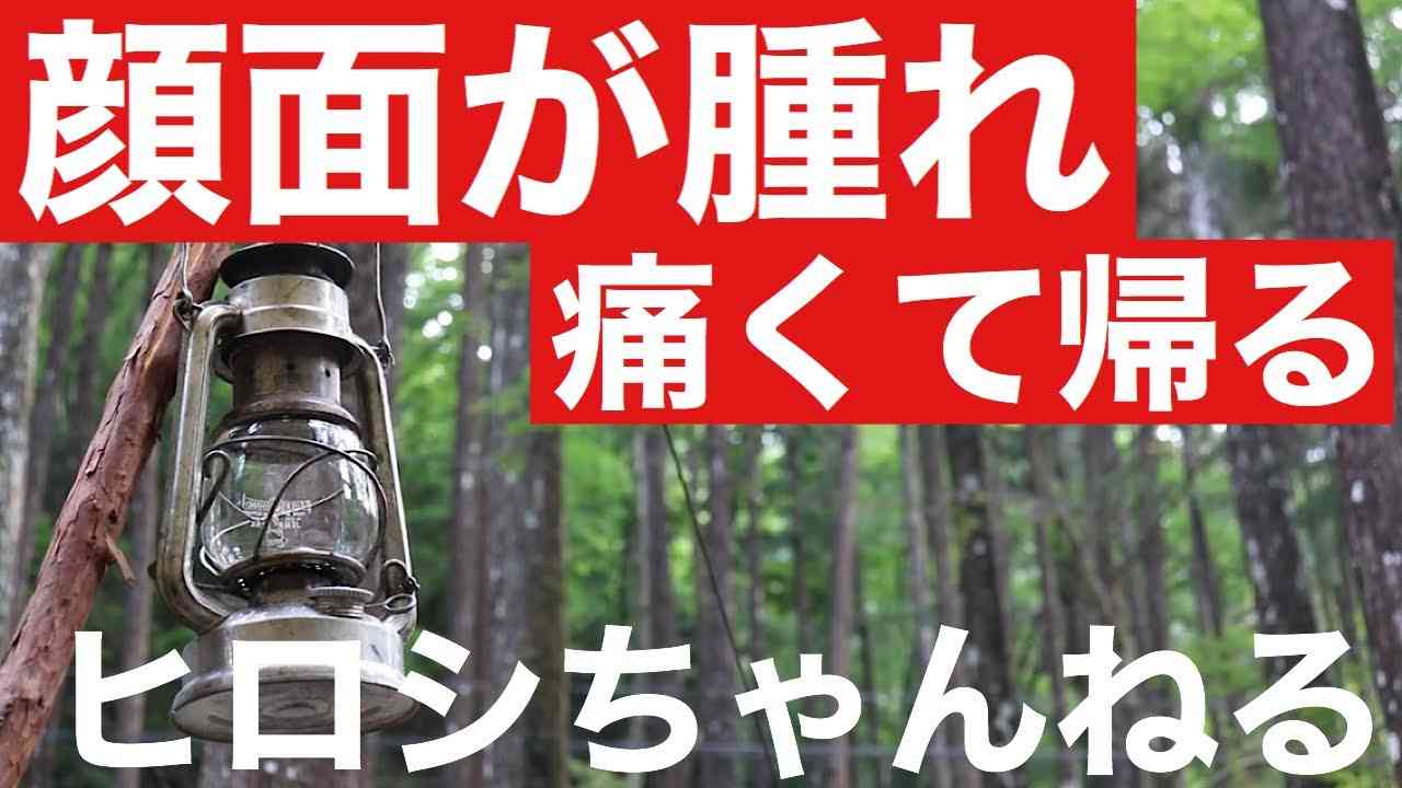 抜いた親知らず痕が痛くて途中で帰るキャンプ - YouTube