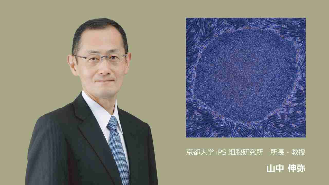 難病やケガで苦しむ人々を救いたい。 山中伸弥所長率いる京都大学iPS細胞研究所に安定した研究環境を！ - Yahoo!ネット募金