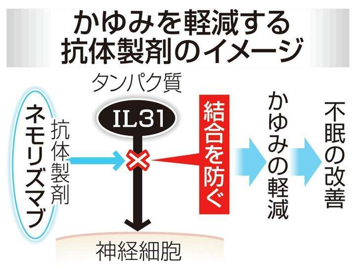 重度のアトピー性皮膚炎の新薬、有効性を確認　京都大など：イザ！
