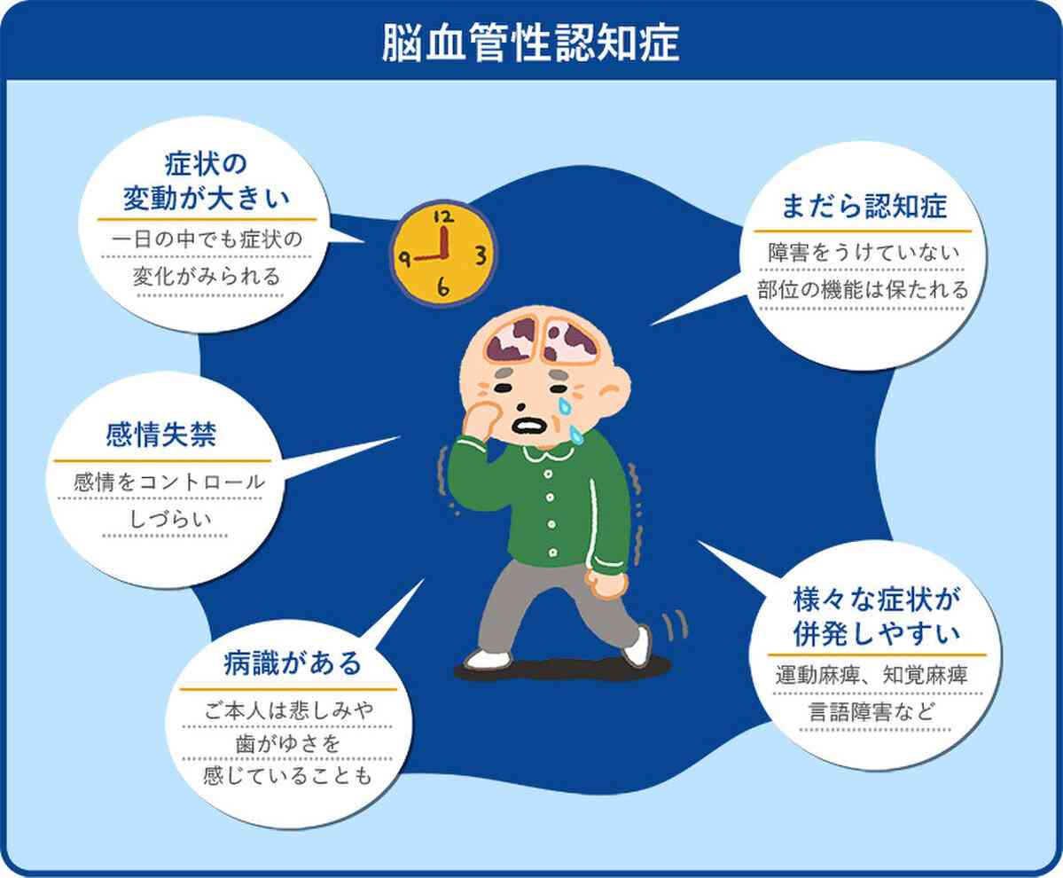 脳卒中は認知症を悪化させる可能性がありますか?