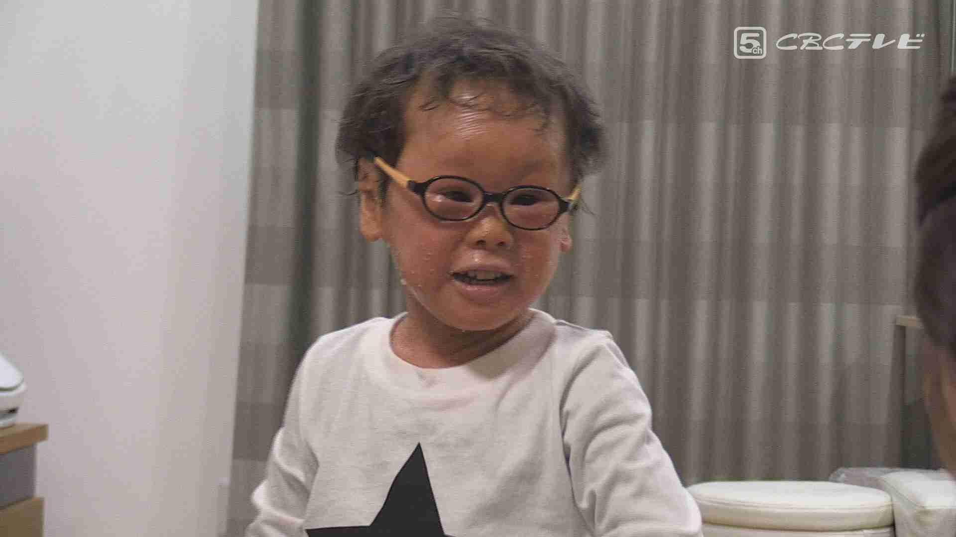 「ピエロと呼ばれた息子」～道化師様魚鱗癬との闘い～（CBCテレビ） - Yahoo!ニュース