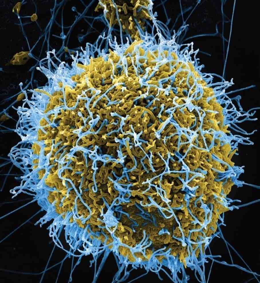 Bill Gates calls on U.S. to lead fight against a pandemic that could kill 33 million - The Washington Post