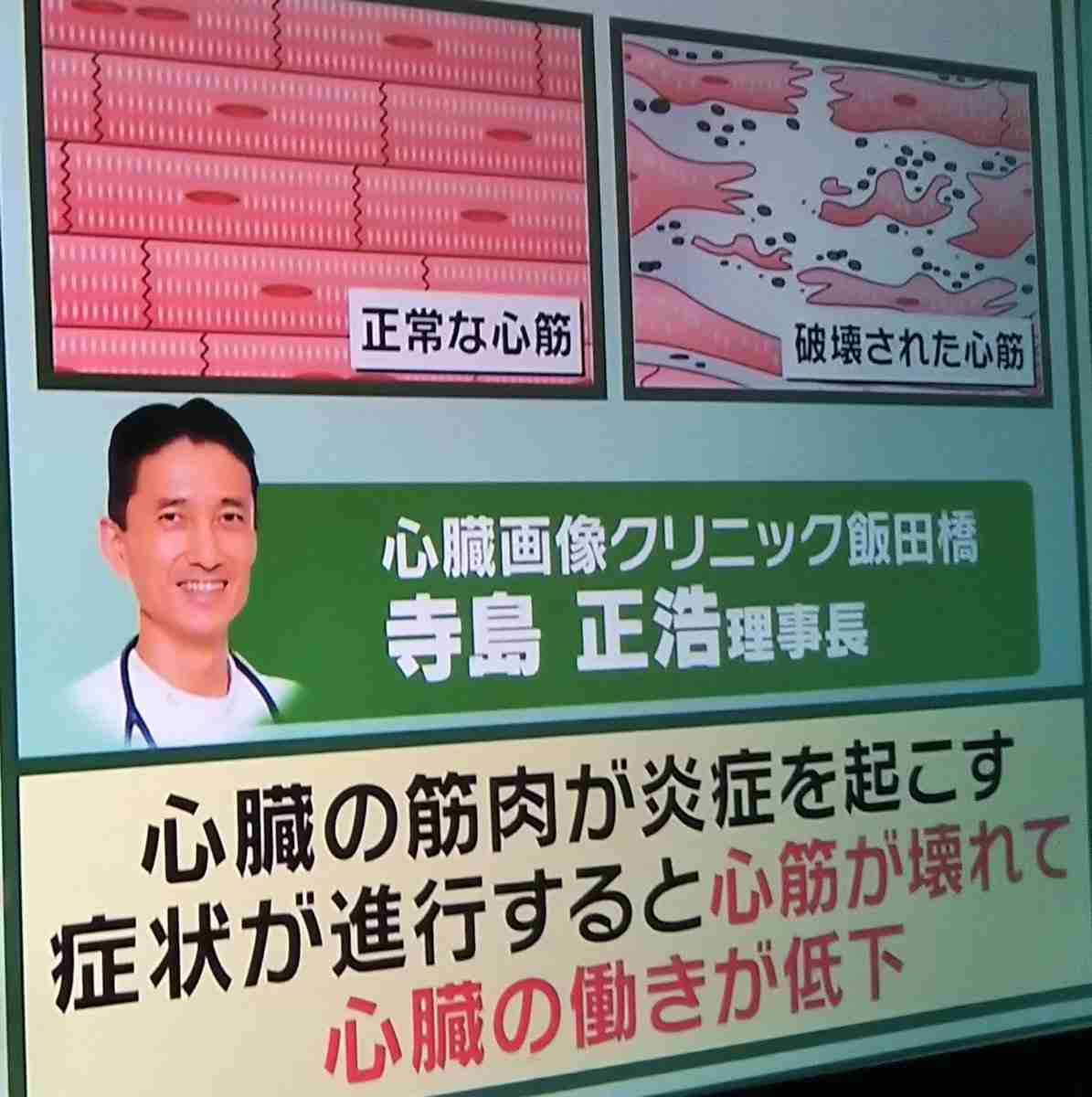 新型コロナの後遺症で心筋炎？　メジャーリーガーは「私は自分が100歳のように感じた」と語る