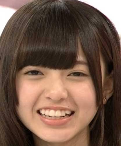 歯列矯正中の食事