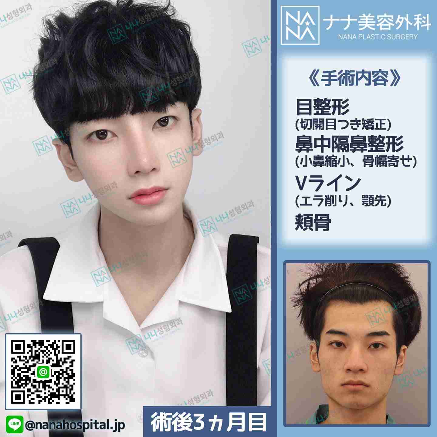 【見た目】彼氏、旦那を垢抜けさせることに成功した人