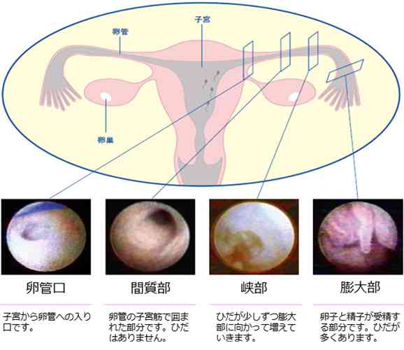 デヴィ夫人が生放送で「不妊になるのは堕胎が原因」「全員堕胎です」と発言