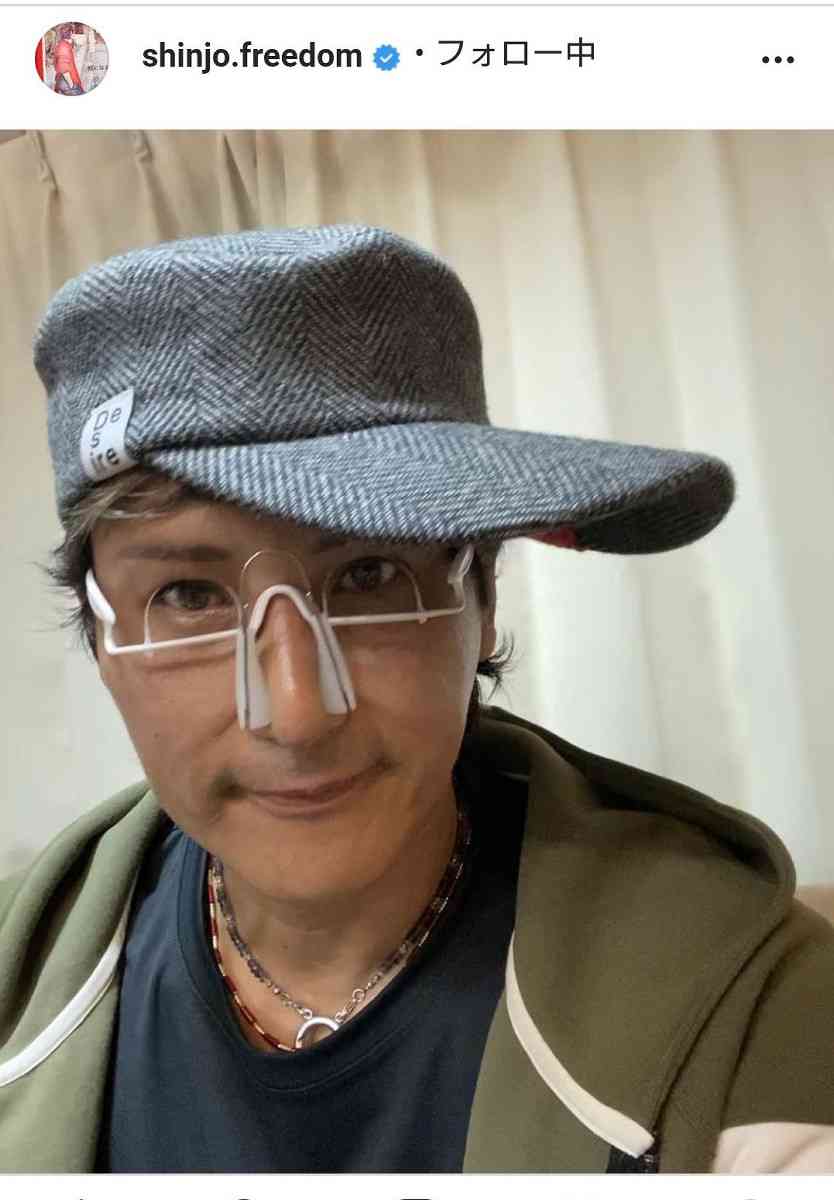 整形公表の新庄剛志氏、さらに鼻高＆目パッチリした姿を披露し「上地雄輔かと思った」の声