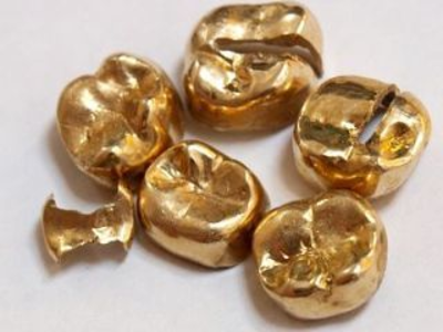 メルカリで売れなくても実は高値がつく! お家に眠る「隠れお宝」教えます 金歯、ペン先、ベルトのバックル…