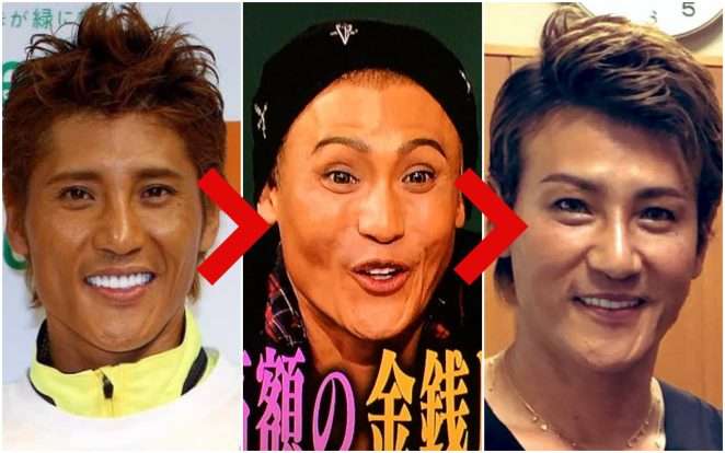 整形公表の新庄剛志氏、さらに鼻高＆目パッチリした姿を披露し「上地雄輔かと思った」の声