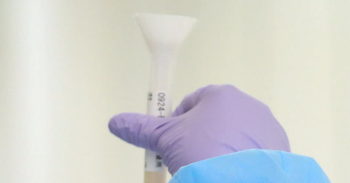 コロナ検体送付、地方在住者の東京都内感染計上が増加: 日本経済新聞