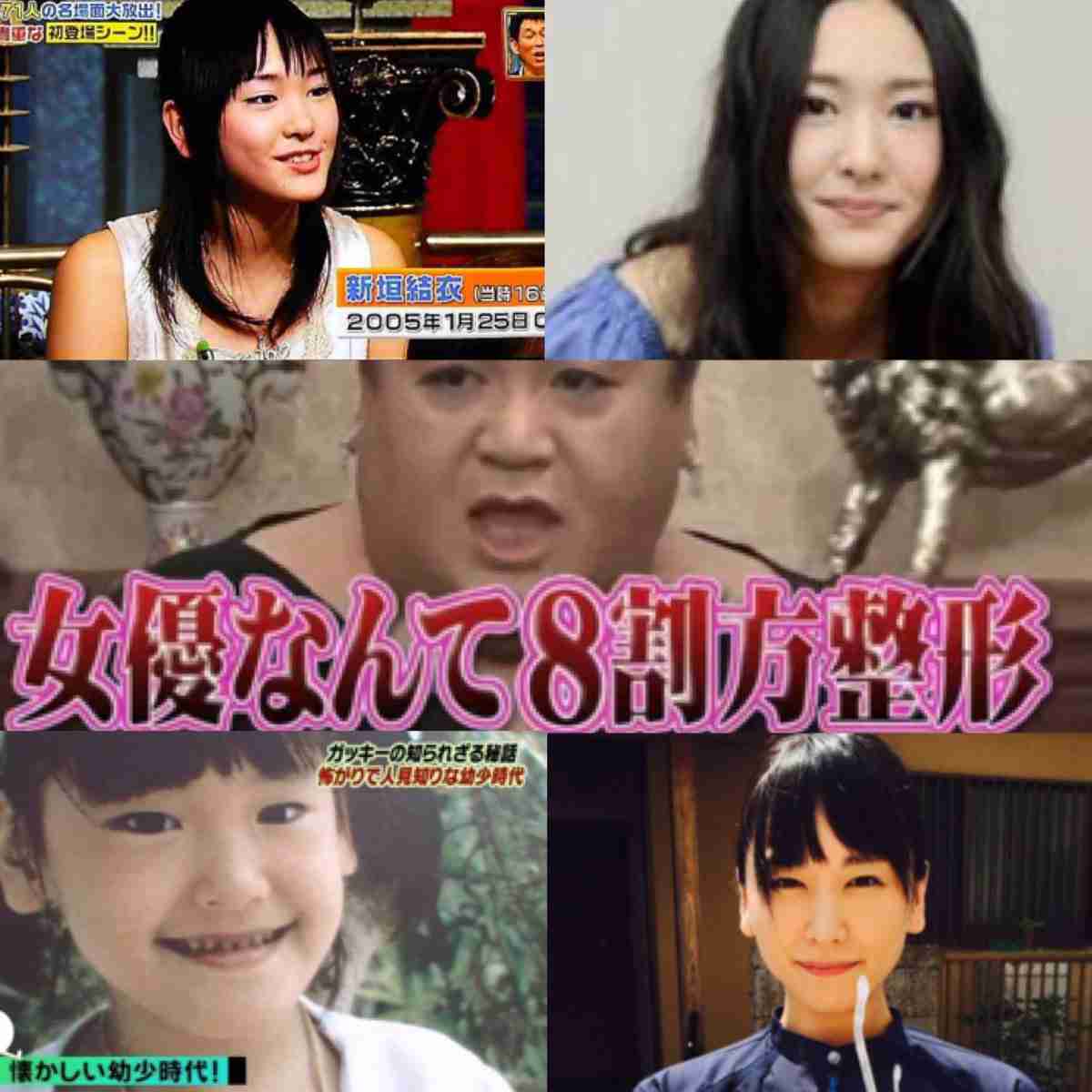 整形で失敗する人と成功する人の違い