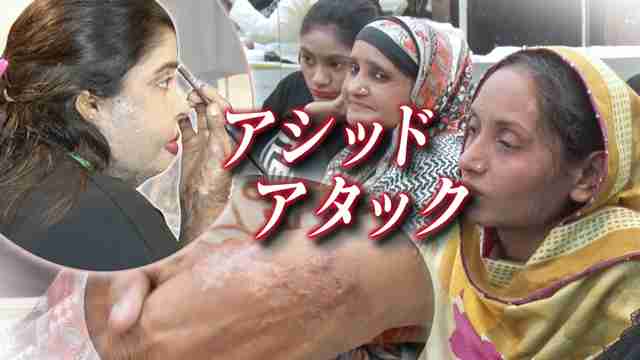 パキスタン 「アシッドアタック」被害女性の社会的自立を | 国際報道2020 [特集] | NHK BS1