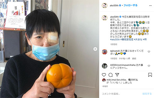 「気が滅入りますが」　和田アキ子、黄斑変性症の注射手術を眼帯姿で報告　ファンから体調気遣う声（ねとらぼ） - Yahoo!ニュース