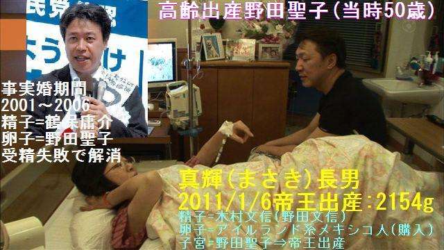 2011年高齢出産野田聖子(50)・体外受精帝王出産・真輝まさき(長男)の闘病 - 種の断片