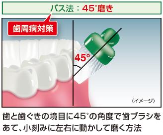 自分でできる歯周病対策