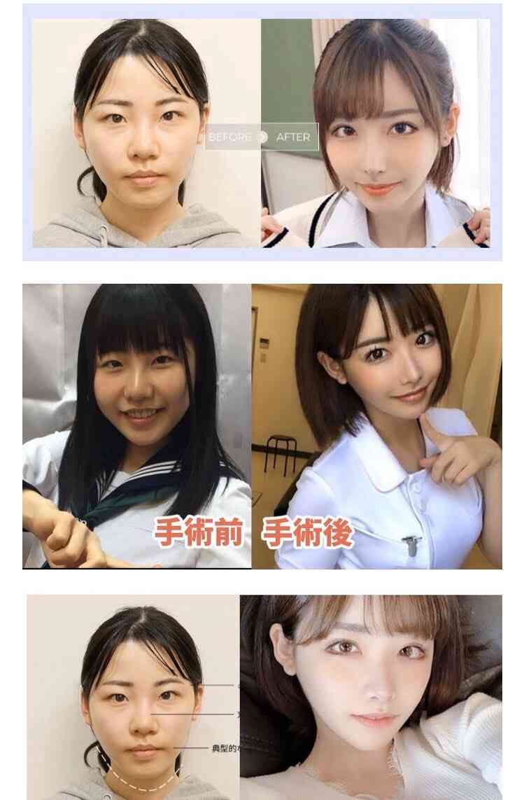整形で失敗する人と成功する人の違い