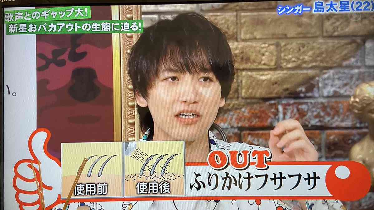 クイズ番組で若手イケメン歌手が「育毛剤を買っている」と告白？「若いのに大変そう」の声も