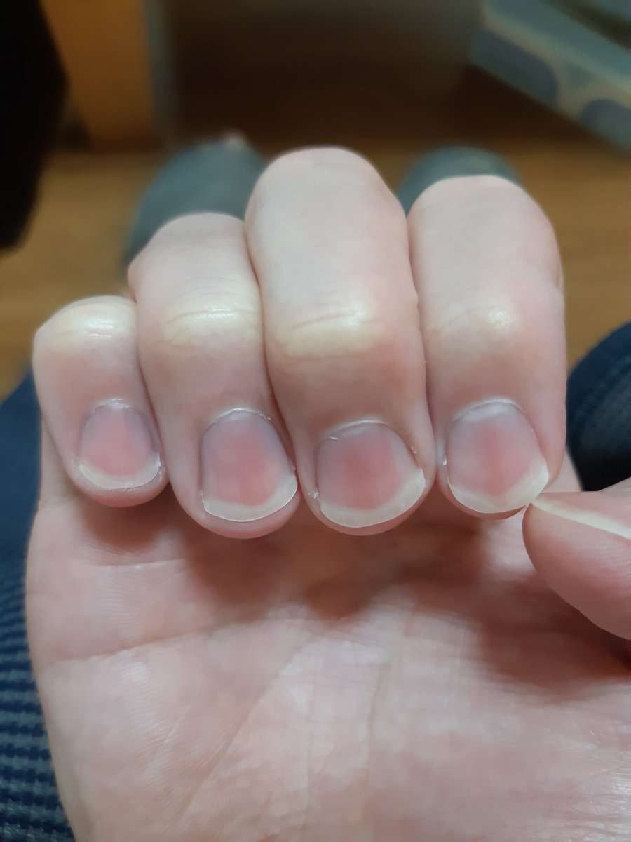 爪をケアするようになって1年、ビフォーアフターが凄い「爪の形変えられるの初めて知った」