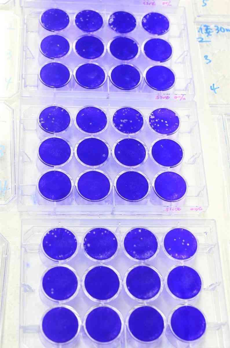 お茶で新型コロナ無害化　1分で最大99％　奈良県立医科大学