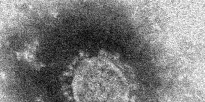 コロナ「指定感染症」延長へ調整　入院や外出自粛措置を継続 ｜ 共同通信