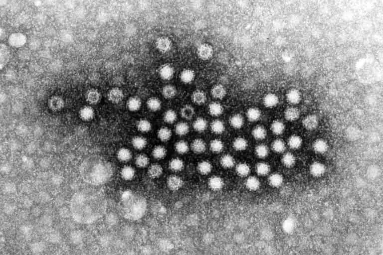 弁当を食べ239人がノロウイルス感染　最も流行するこの季節の注意点とは