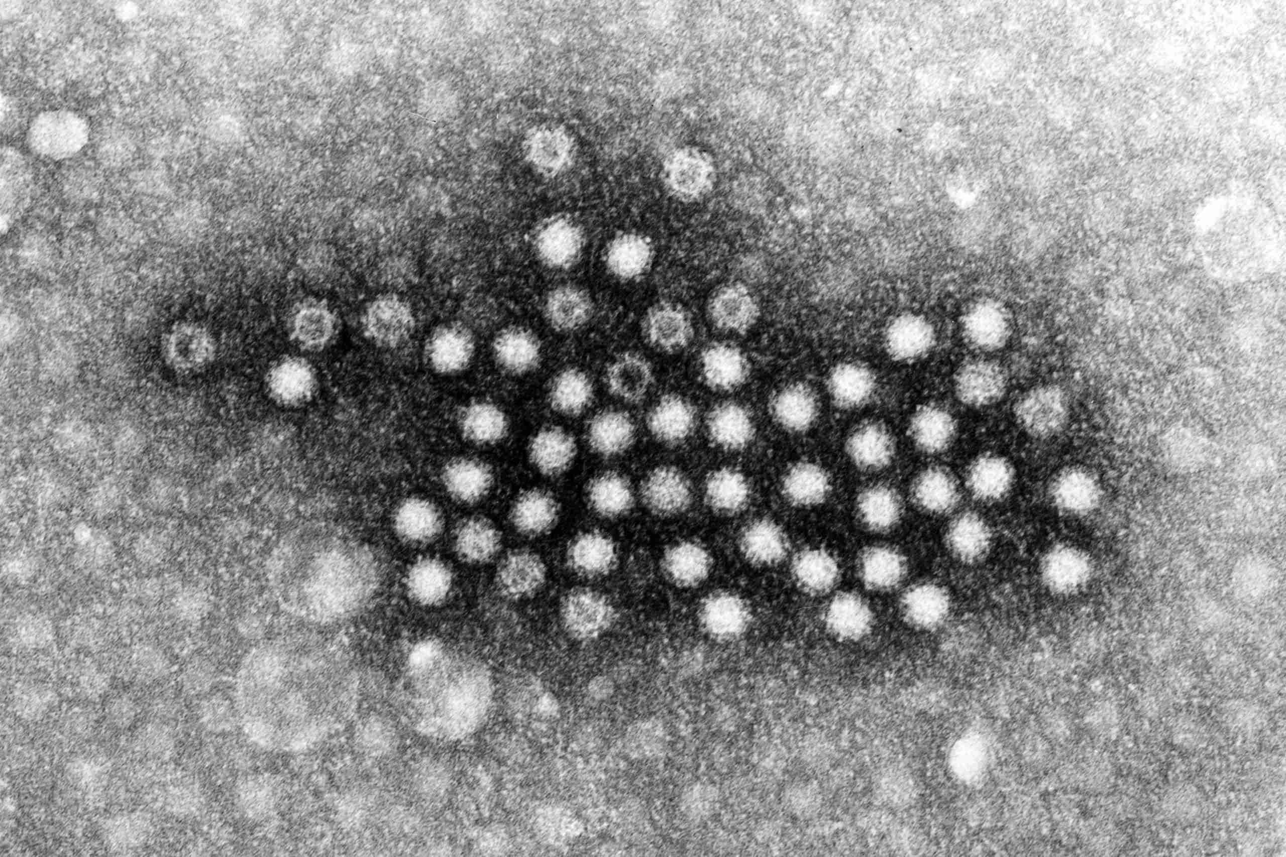 弁当を食べ239人がノロウイルス感染　最も流行するこの季節の注意点とは – ニュースサイトしらべぇ