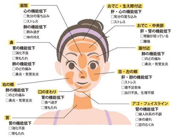 ニキビの位置で体の不調がわかる と図が拡散 専門医 全くの都市伝説 ガールズちゃんねる Girls Channel