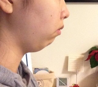 口元の悩み　【総合】