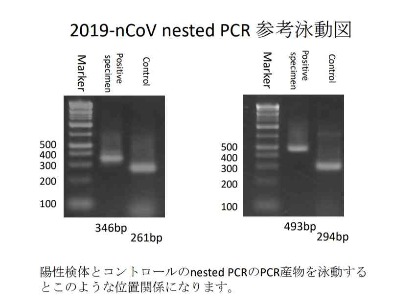 2900円でPCR検査　新橋駅前に民間施設開業―新型コロナ