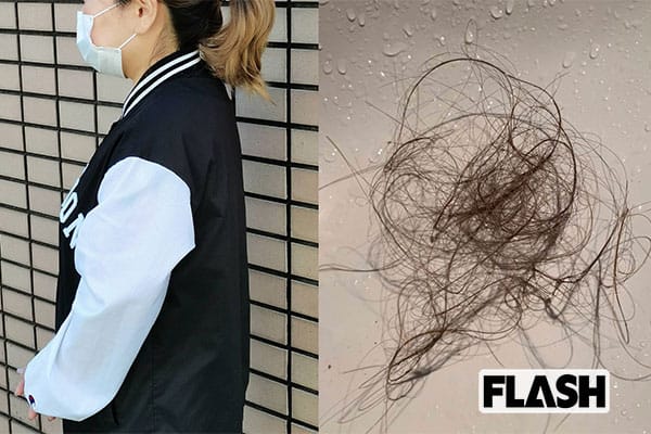 新型コロナ「後遺症外来」に女性が殺到か 「脳の霧」で仕事にも支障？ - ライブドアニュース