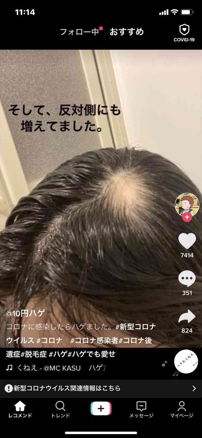 朝日奈央 友人の新型コロナ後遺症を語る「改めて怖さを知った」