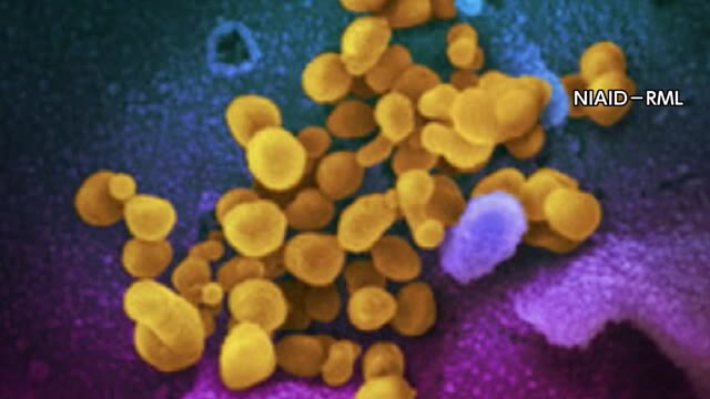 【速報】鳥取県内で新たに新型コロナ感染者２人確認　西部地区在住の３０代男性と２０代女性（TSKさんいん中央テレビ） - Yahoo!ニュース