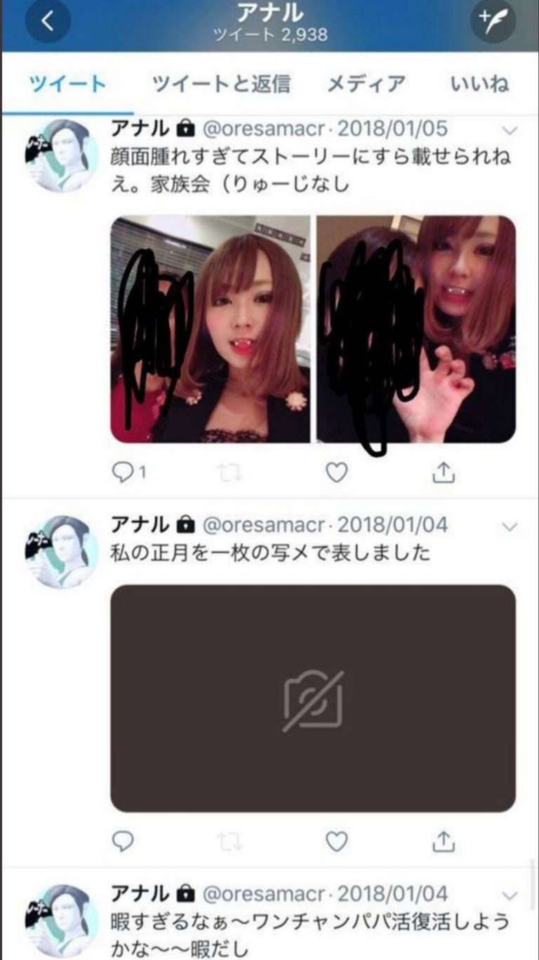 またお騒がせ…てんちむ　脱毛サロンの広告案件で説明不足を謝罪