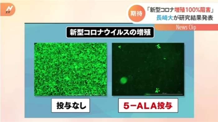 「新型コロナ増殖１００％阻害」 長崎大が研究結果発表｜TBS NEWS