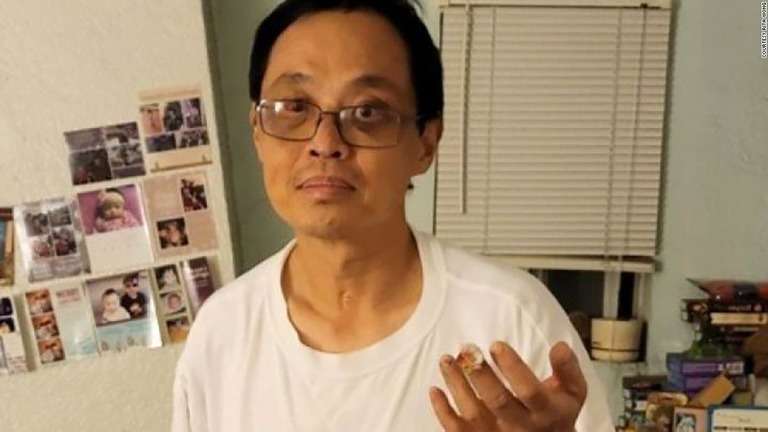 CNN.co.jp : アジア系男性がいきなり襲撃される、手術で指切断の重傷　米加州