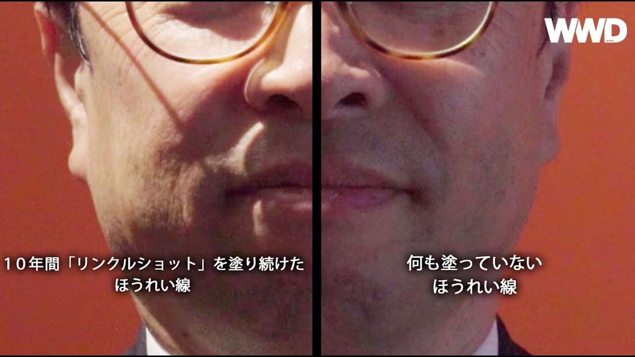 ポーラの「リンクルショット」から20代にも見られる“潜伏シワ”を改善する全顔用美容液登場 - YouTube
