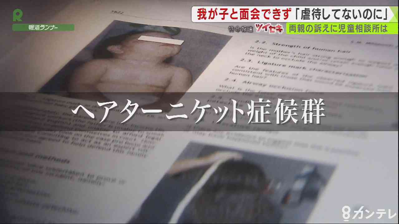 毛髪巻きつく事故だったのに…児相が2歳児と両親を5カ月面会させず　家庭に戻れたのは1年後