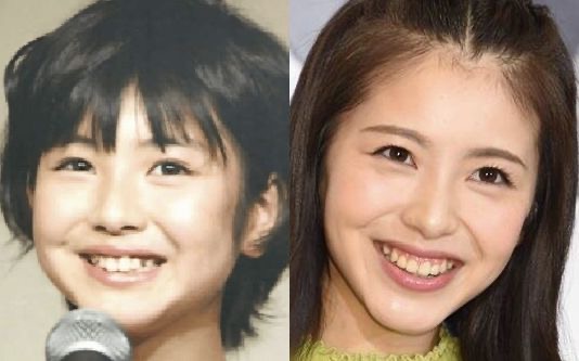 整形していない有名人