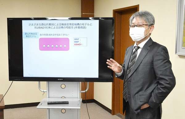 歯の再生治療薬につながる中和抗体の開発成功　世界初、福井大と京都大チーム（福井新聞ＯＮＬＩＮＥ） - Yahoo!ニュース