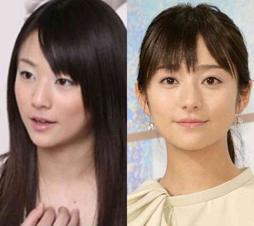 整形していない有名人