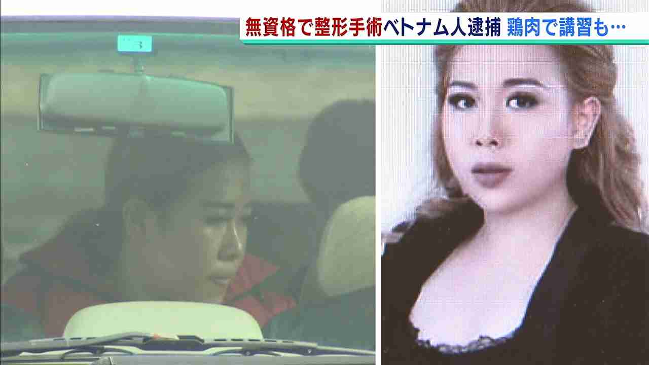 無免許で『鼻高くする注射』など美容整形手術…ベトナム人女ら逮捕　組織的な可能性も
