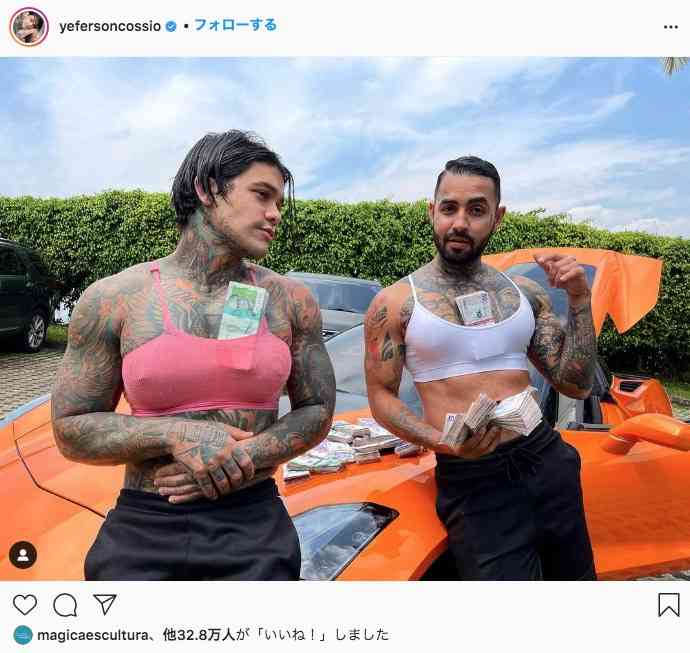 面白半分で インスタグラマーの男性 フォロワー数を賭けた勝負で豊胸手術を受ける コロンビア ガールズちゃんねる Girls Channel