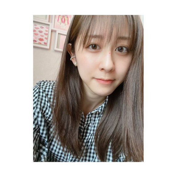 テレ朝・斎藤ちはるアナ 痛々しい傷…顔面に携帯落とし赤い傷 「そこは痛い」「めっちゃ痛そう!」