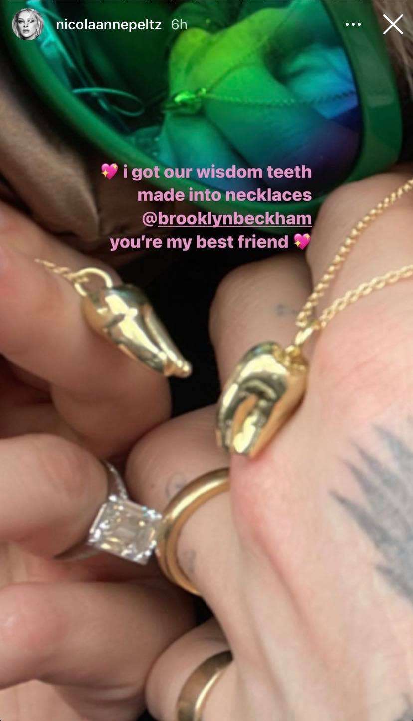 ブルックリン・ベッカム、婚約者から贈られた“親知らず”のネックレスにドン引きの声