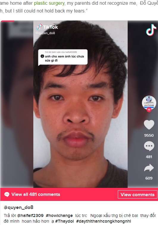【海外発！Breaking News】「君の容貌では就職できない」と言われた26歳男性、整形でまるで別人に　親でさえ認識不可（ベトナム） | Techinsight（テックインサイト）|海外セレブ、国内エンタメのオンリーワンをお届けするニュースサイト