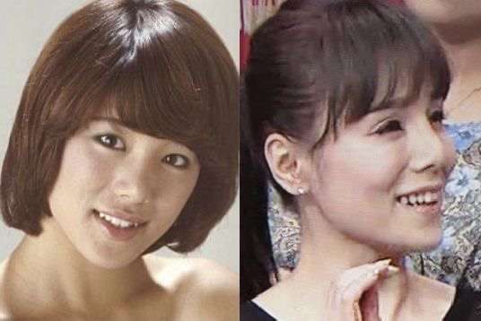 整形していない有名人