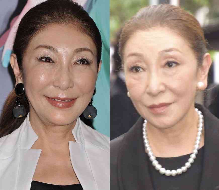 整形していない有名人