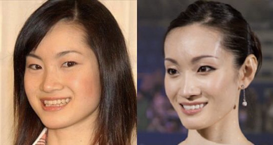 整形していない有名人