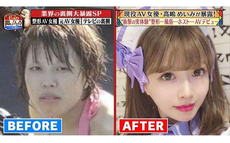 整形してAVデビュー！　現役セクシー女優・高嶋めいみが整形前の顔を公開：じっくり聞いタロウ｜テレ東プラス